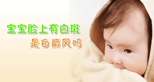 白癜風(fēng)部位